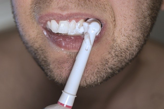 הלבנת שיניים: חיוך של מיליון דולר